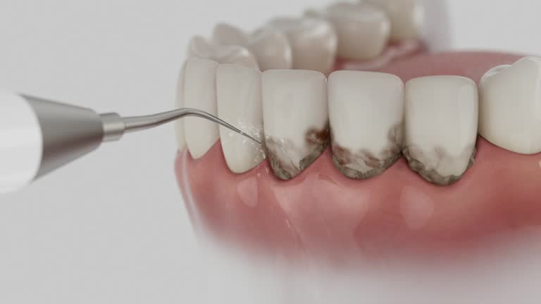 Reliable Tooth Extraction contractor in St. Louis city County, MO by Dentist Open Now